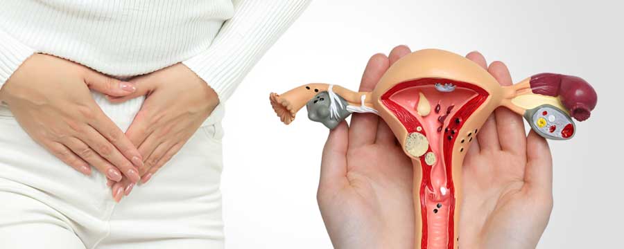 Bursitis Physiotherapy